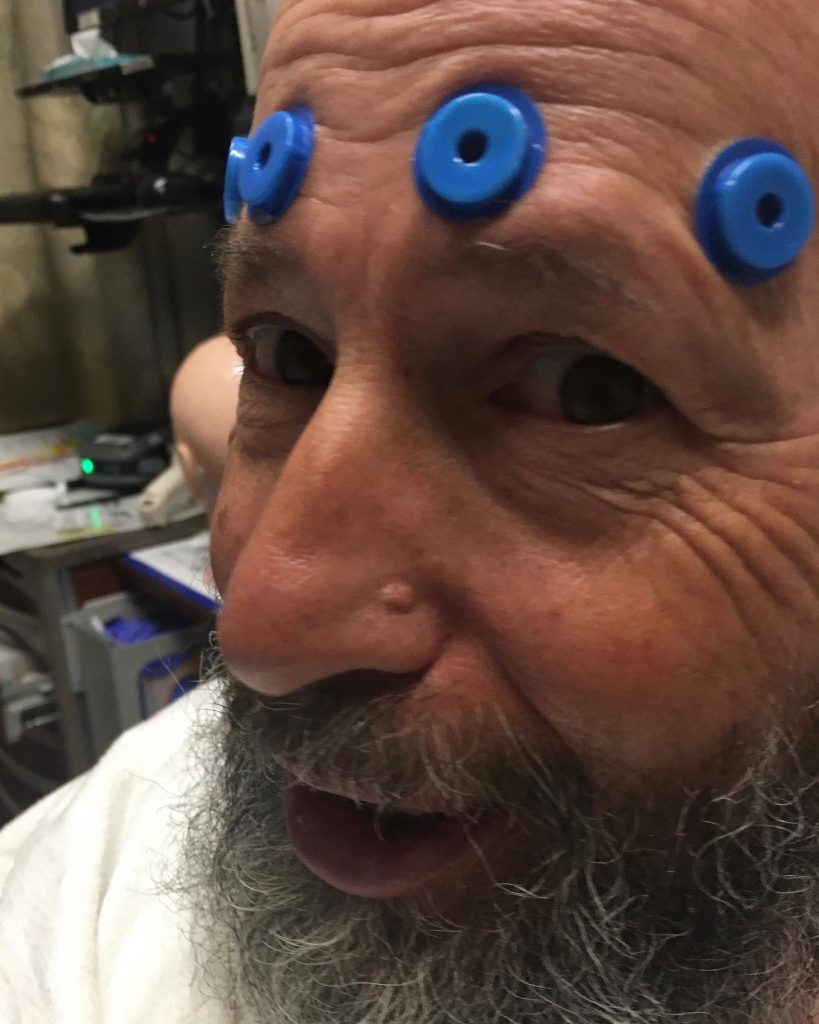 A man with electrodes on head